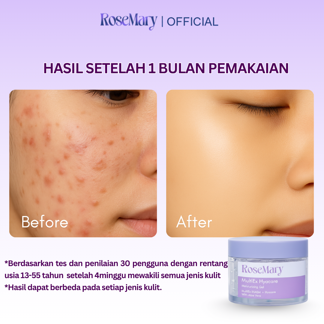 Rosemary MultiEx Hyacare Moisturizing Gel Melembabkan Redakan Iritasi Kontrol Minyak & Bekas Jerawat - Image 4