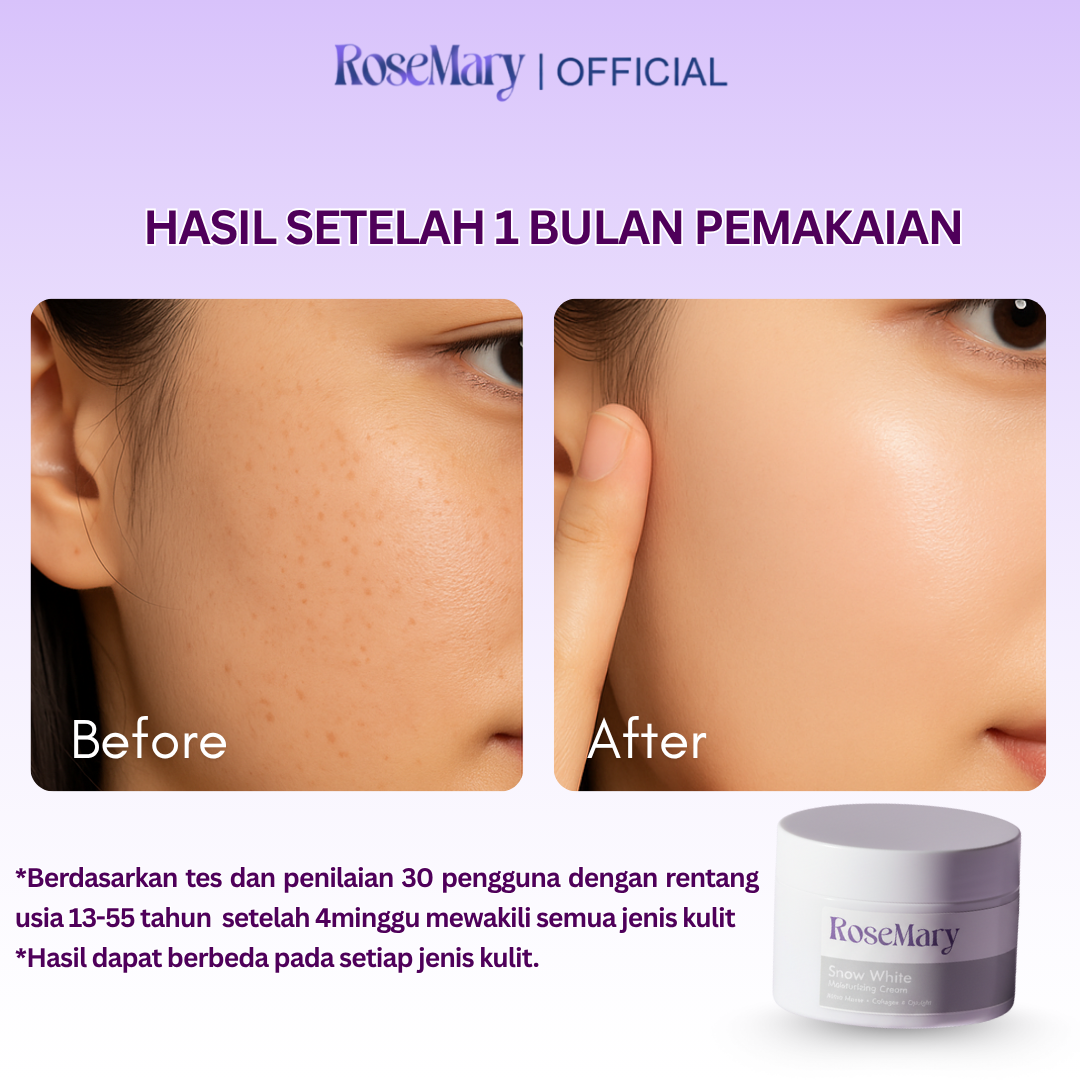 Rosemary Snow White Moisturizing Cream Mencerahkan Melembabkan Atasi Bekas Jerawat Flek Hitam - Image 3