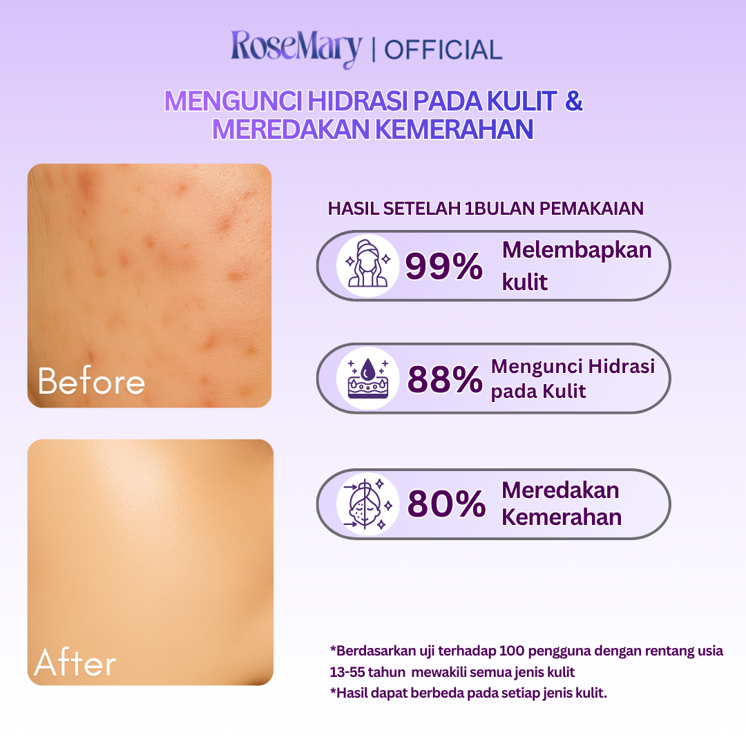 Rosemary MultiEx Hyacare Moisturizing Gel Melembabkan Redakan Iritasi Kontrol Minyak & Bekas Jerawat - Image 5