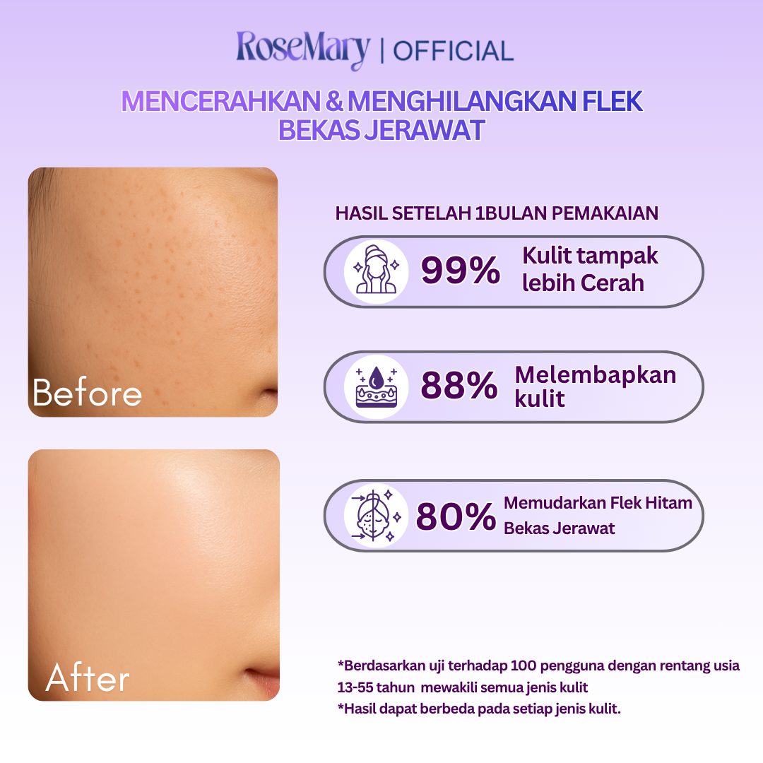 Rosemary Snow White Moisturizing Cream Mencerahkan Melembabkan Atasi Bekas Jerawat Flek Hitam - Image 4