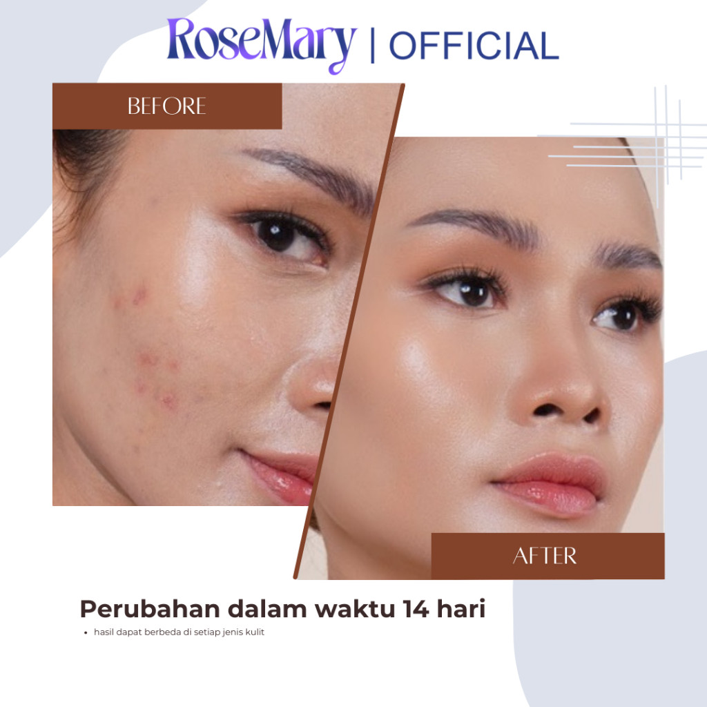ROSEMARY AHA Ceramide Essence Toner 100 ml | Brightening Toner | Soothing Toner | Barrier toner | Exfoliating toner toner badan face mist hydrating AHA Toner - Image 4