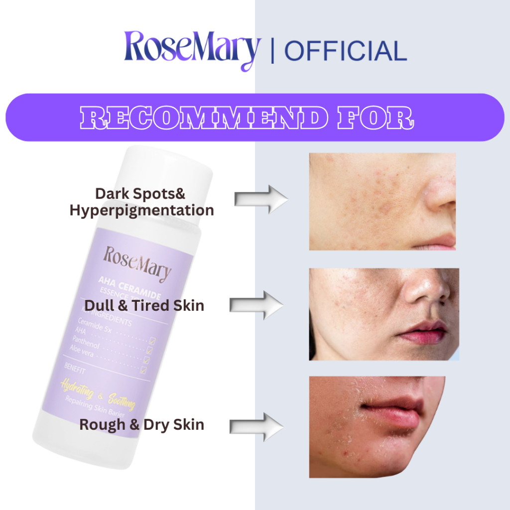 ROSEMARY AHA Ceramide Essence Toner 100 ml | Brightening Toner | Soothing Toner | Barrier toner | Exfoliating toner toner badan face mist hydrating AHA Toner - Image 12